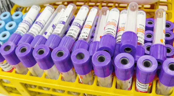 У 126 воронежцев нашли коронавирус за сутки