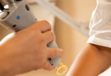 Лазерная эпиляция тела и лица: подготовка, курс и прогнозируемый эффект