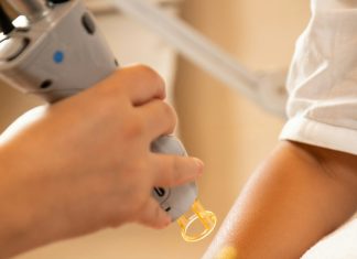 Лазерная эпиляция тела и лица: подготовка, курс и прогнозируемый эффект