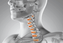 Лечение позвоночника и суставов: восстанови свой «стержень» и «шарниры»